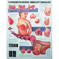 Chart Understanding Breast Disease Each