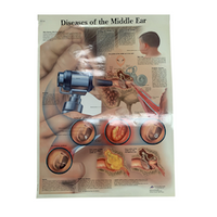 Poly-Laminated Biological Chart - Middle Ear Diseases Each