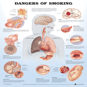 Chart, "Dangers of Smoking" 51 x 66cm, Rigid, Each Each