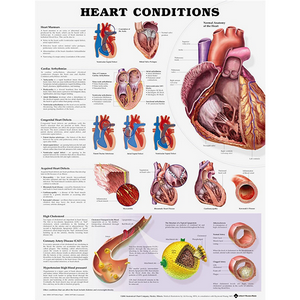 Heart Conditions Chart, 51 x 66cm, Rigid, Each Each