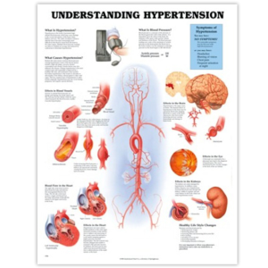 UNDERSTANDING HYPERTENSION CHART 51 X 66CM RIGID Each