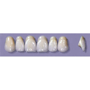 MYERSON ANTERIORS #A72/70 (1x6CARD) Card
