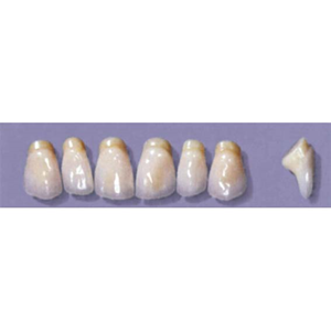 Myerson Anteriors #PM6/58 (1 x 6 Card), Each