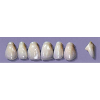 Myerson Anteriors #PW4/58 (1 x 6 Card), Each