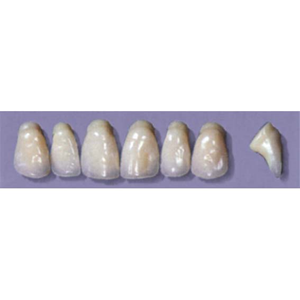 MYERSON ANTERIORS #PW6/58 (1x6CARD) Card