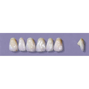 Myerson Anteriors #YM3/58 (1 x 6 Card), Each