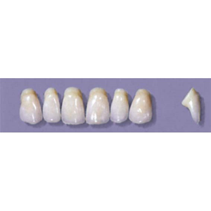 Myerson Anteriors #YM5/58 (1 x 6 Card), Each
